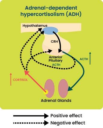 ACTH-independent hypercortisolism (cushings syndrome)